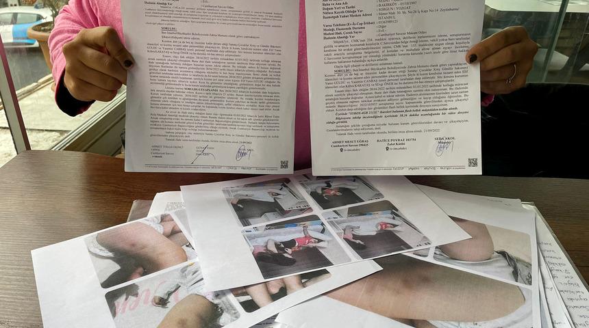 Kreşte 2 yaşındaki kızının uyutulurken darbedildiğini fark eden anne şikayetçi oldu