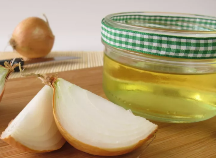 Siğilleri kökten kurutacak! Düzenli kullanımda kurtulmanın yolu çok basit G4