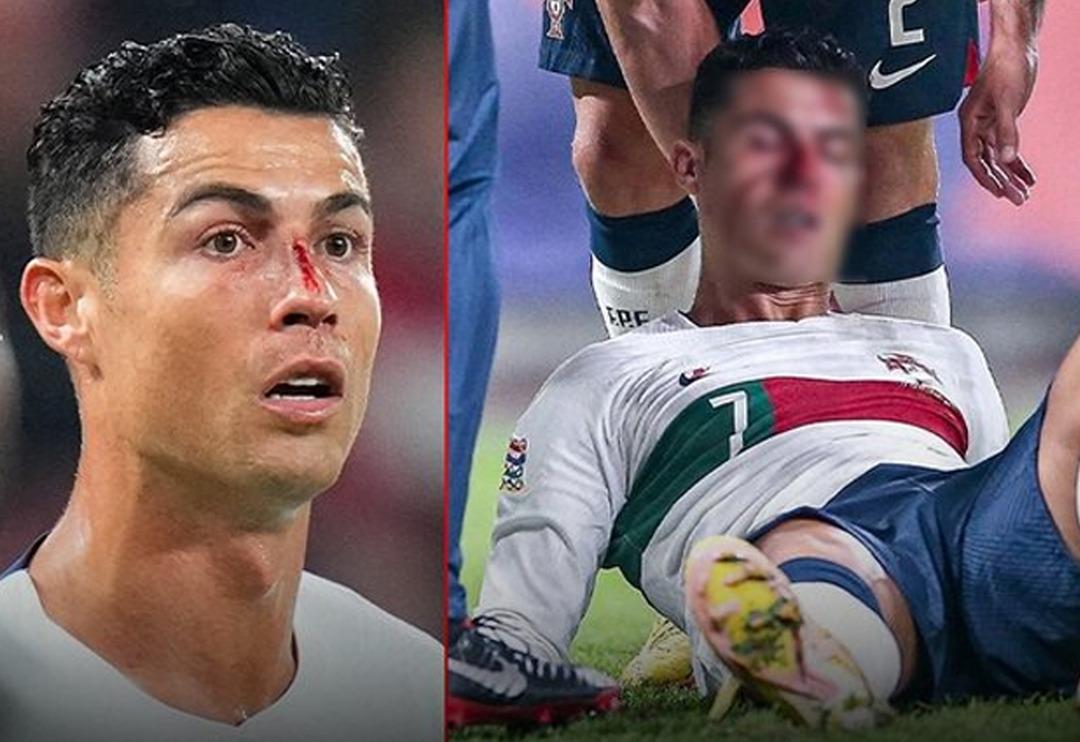 Cristiano Ronaldo'nun antrenmandaki g&ouml;r&uuml;nt&uuml;s&uuml; i&ccedil;ler acıttı! Y&uuml;z&uuml; morluk i&ccedil;inde...