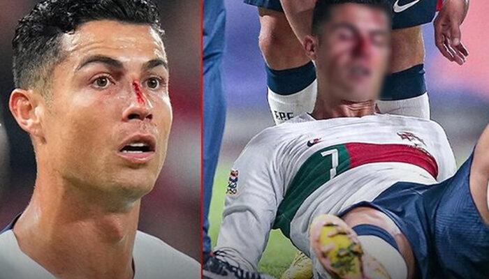 Cristiano Ronaldo'nun antrenmandaki görüntüsü içler acıttı! Yüzü morluk içinde...