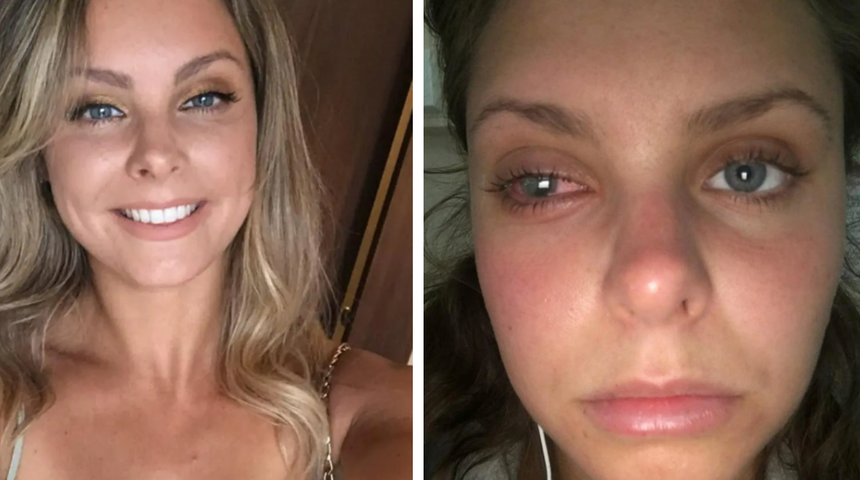 Bu hata uyarılara rağmen tekrarlanıyor! Kirli makyaj çantası nedeniyle kısmi kör kaldı