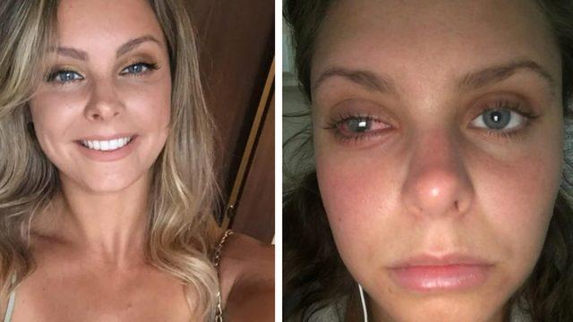 Bu hata uyarılara rağmen tekrarlanıyor! Kirli makyaj çantası nedeniyle kısmi kör kaldı