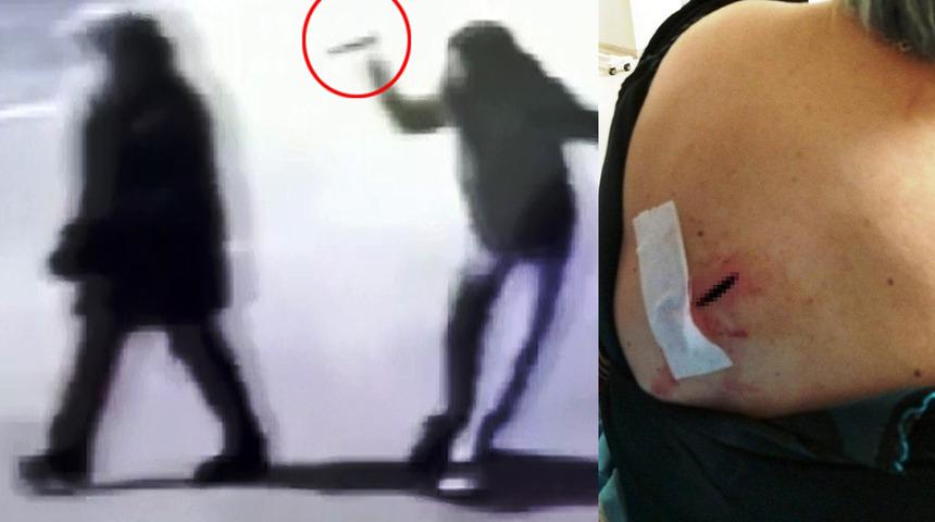 İşe giderken sırtından bıçaklandı, dehşeti yaşadı! Her detayı korkunç... Şimdi dışarıya çıkmaktan korkuyor...