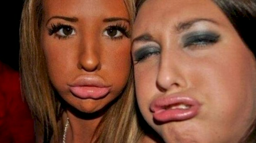 19- URSUSAGALMATOPHİLİA