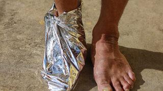 Alüminyum folyonun bilinmeyen yönü: O bölgeyi sarın, bekleyin...