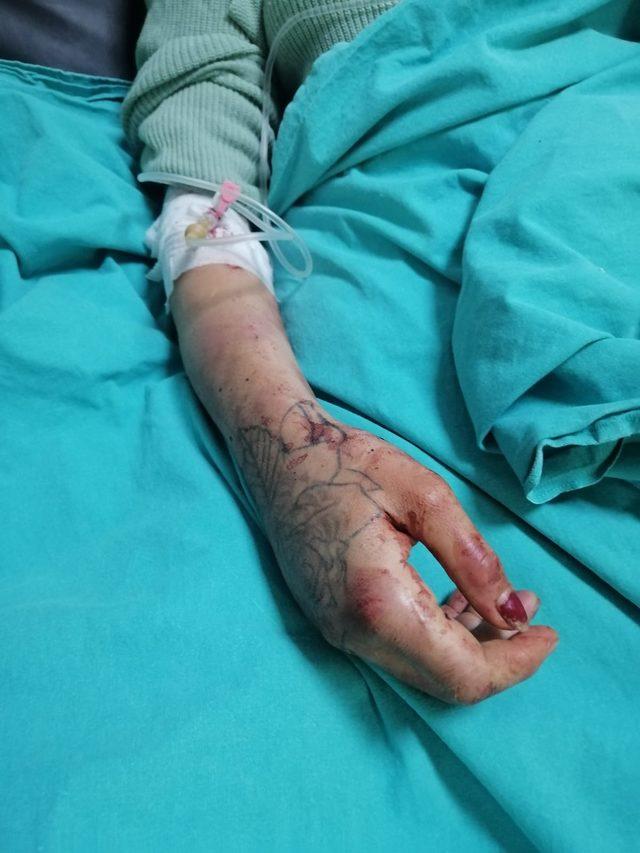 Mersin'de kadını bıçakla ve darbederek yaralayan zanlı ile arkadaşı tutuklandı