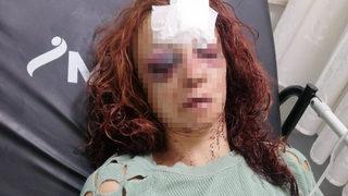 Mersin'de kadını bıçakla ve darbederek yaralayan zanlı ile arkadaşı tutuklandı