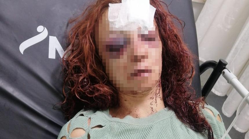 Mersin'de kadını bıçakla ve darbederek yaralayan zanlı ile arkadaşı tutuklandı