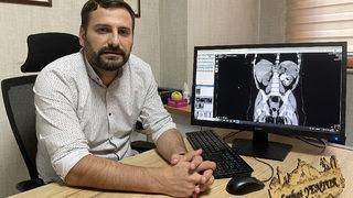 Elazığ'da 13 aylık bebeğin böbreğindeki 5 santimetrelik taş ameliyatla çıkarıldı