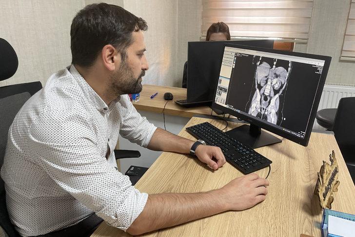 Elazığ'da 13 aylık bebeğin böbreğindeki 5 santimetrelik taş ameliyatla çıkarıldı G2