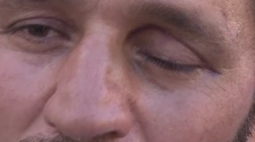 Topladığı incir kabusu oldu! 'Gözüm görmüyor, beynim de kırık kolum da'