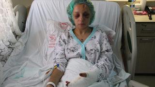 Mersin'de 2 şüpheli bıçakla yaraladıkları kadını kriko ve jantla da darbetmiş