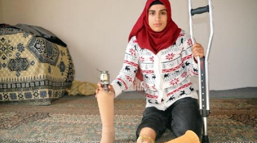 Neslihan'ın tek isteği elektronik protez