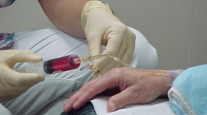 Rektum kanserinde ışın tedavisi ve kemoterapi