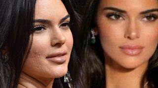 Kendall Jenner'ın sadece iki malzeme ile yaptığı sivilce geçiren maskesi! Tamamen doğal malzemeler ile etkili çözüm