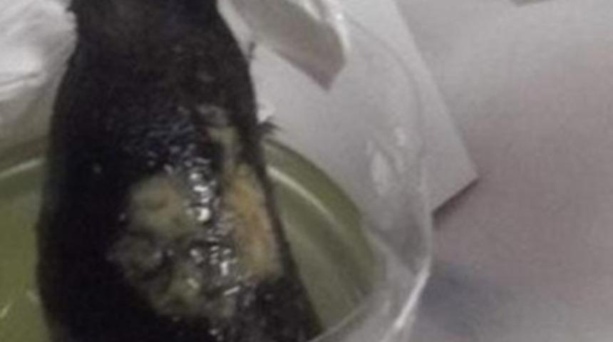 Midesinden 1 kilo sa&ccedil; teli &ccedil;ıktı!