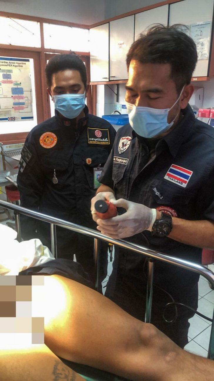 Cinsel organını büyütmek için tam 4 ay boyunca metal halka taktı! Halka sıkışınca itfaiye ekipleri çıkarttı G2