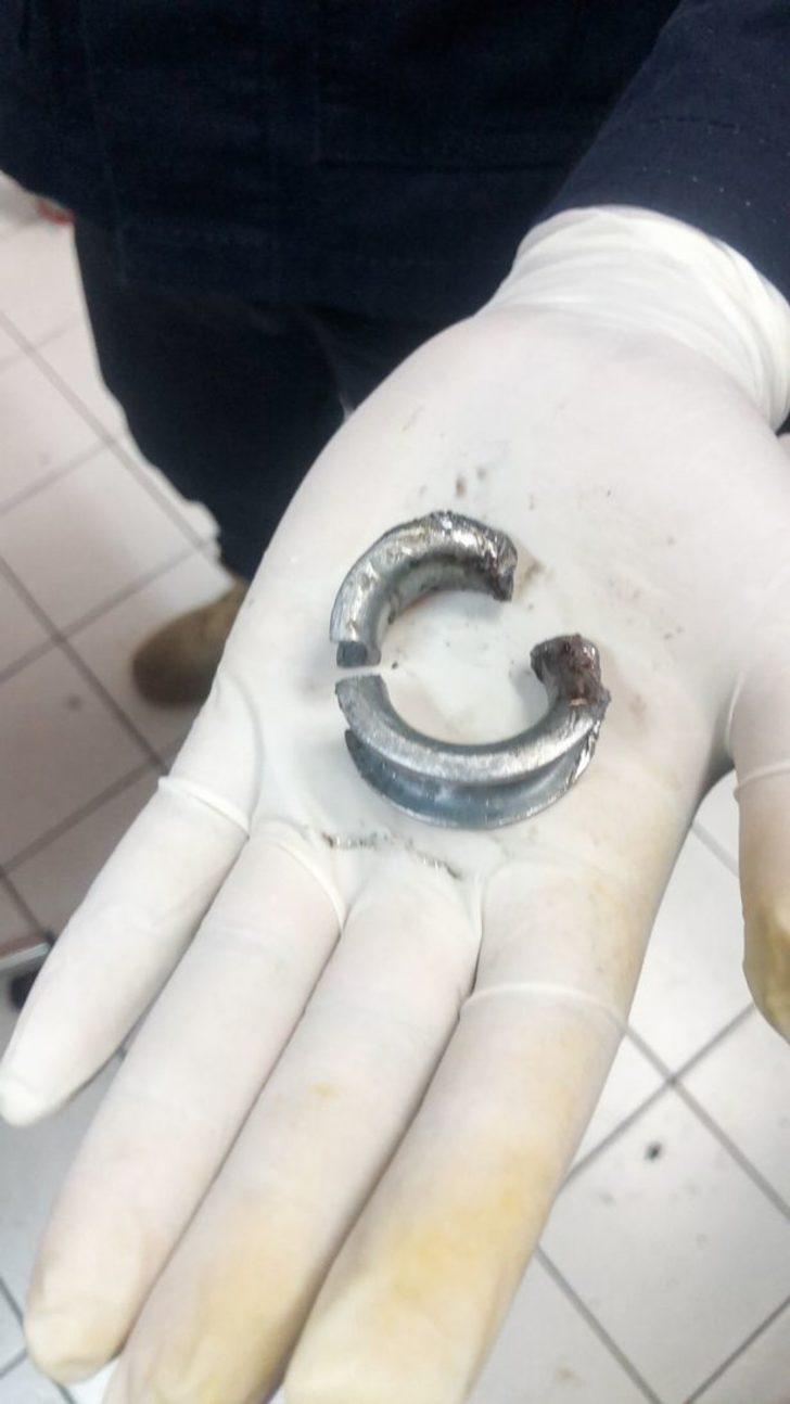 Cinsel organını büyütmek için tam 4 ay boyunca metal halka taktı! Halka sıkışınca itfaiye ekipleri çıkarttı G3