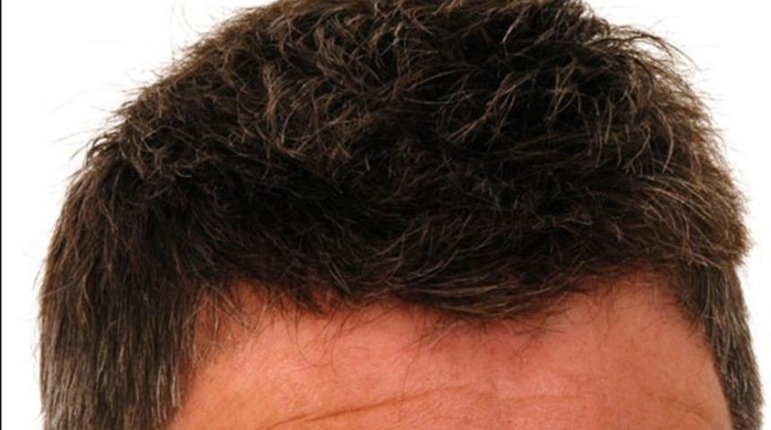 Sa&ccedil; ekim işlemi pahalı bir işlem midir?