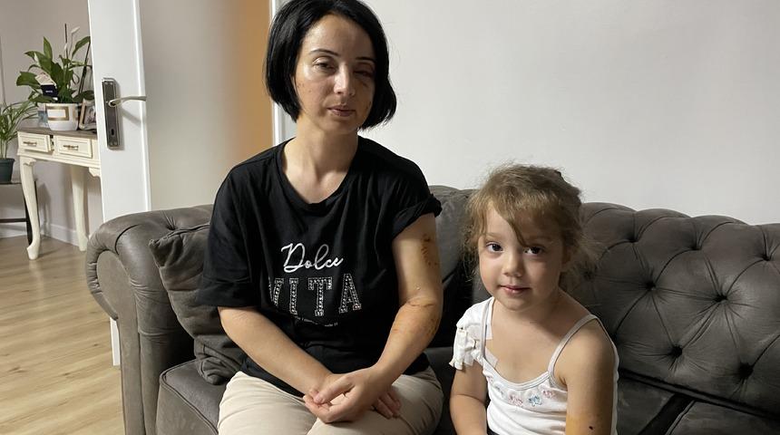 Samsun'da iki köpeğin saldırısına uğrayan anne ile kızı yaralandı