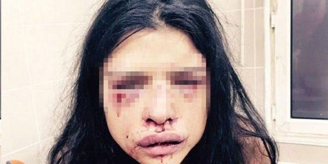 Onur Özbizerdik hakkında yakalama kararı 1