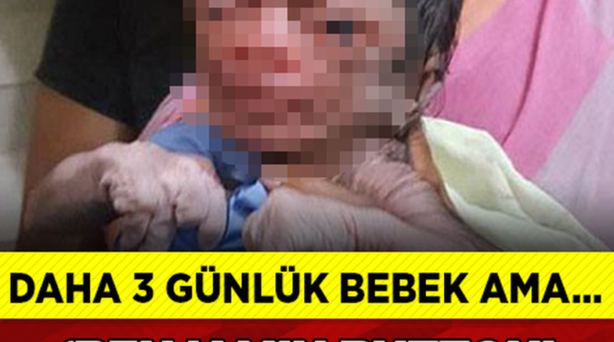 Daha 3 G&uuml;nl&uuml;k Bebek Ama Benjamin Button Efsanesi Ger&ccedil;ek'mi Oluyor?