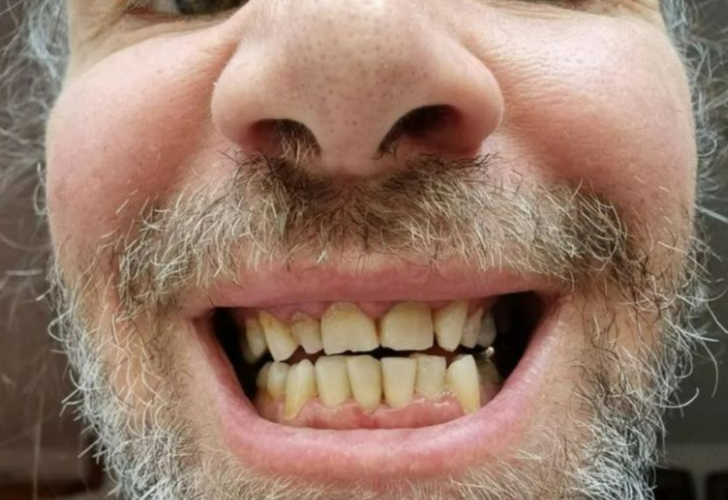 Dişlerini yaptırmak için Türkiye'ye gelen adam büyük hüsran yaşadı! Günlerce çalışamadı