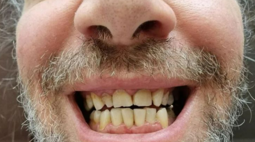 Dişlerini yaptırmak için Türkiye'ye gelen adam büyük hüsran yaşadı! Günlerce çalışamadı