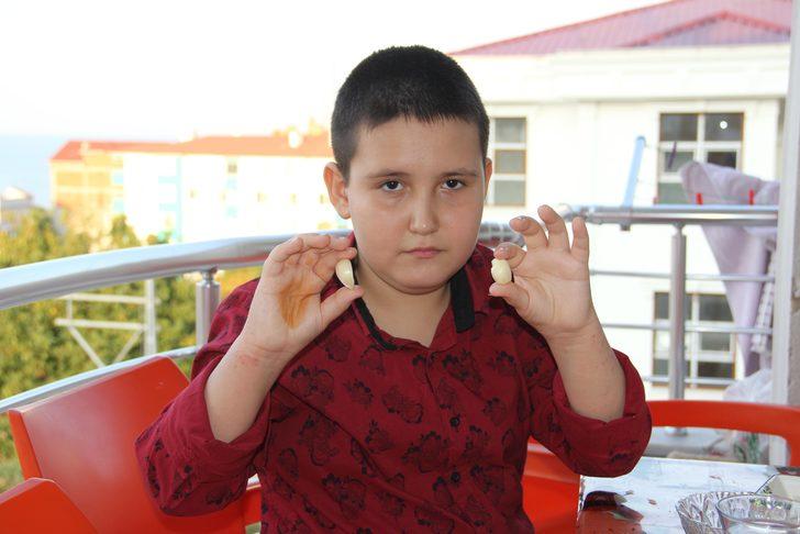 9 yaşındaki Muhammed leblebi yer gibi sarımsak yiyor! 'Her gün en az beş diş yiyorum, hiç hasta olmadım' G1