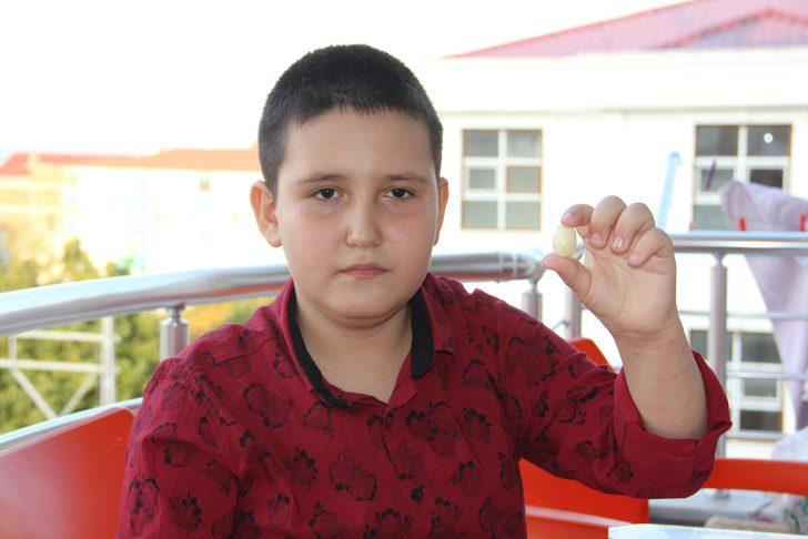 9 yaşındaki Muhammed leblebi yer gibi sarımsak yiyor! 'Her gün en az beş diş yiyorum, hiç hasta olmadım' G2