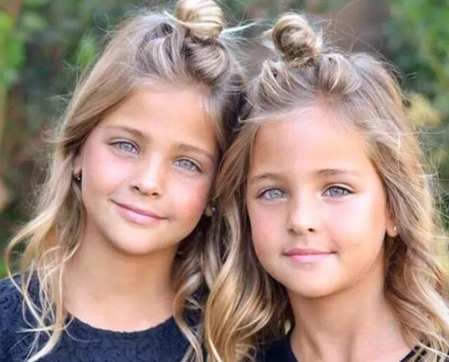 Dünyanın en güzel ikiz çocuklarıydı! Son hallerine yorum yağdı