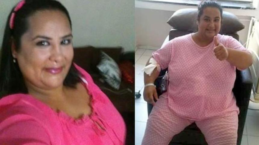 Eski Eşine Kızdı Mide K&uuml;&ccedil;&uuml;ltme Ameliyatı Oldu Hayatı Kabus Oldu