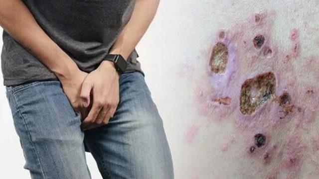 Doktora danışmadan ilaç kullandı: Her şey ters gitti, hayatı karardı!