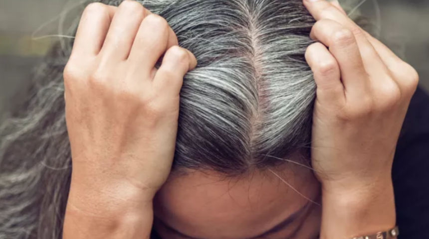 Saç boyasına para vermeye son! Saçtaki beyazları azaltacak doğal çözüm