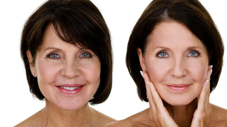 Kırışıklıklar ameliyat olmadan nasıl gider? 5 farklı y&ouml;ntem ile gen&ccedil;leşiyoruz