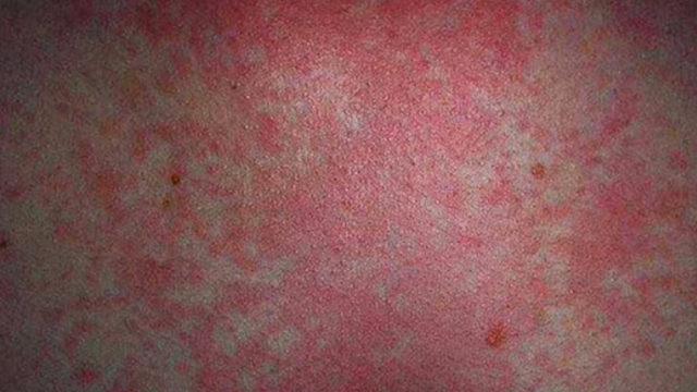 Böylesi dünyada ilk: Yıllardır bununla yaşıyor! Nedeni “yok artık” dedirtti