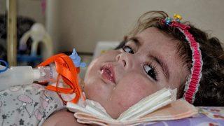 Manisa'da SMA hastası Duru bebek için düzenlenen voleybol turnuvası başladı