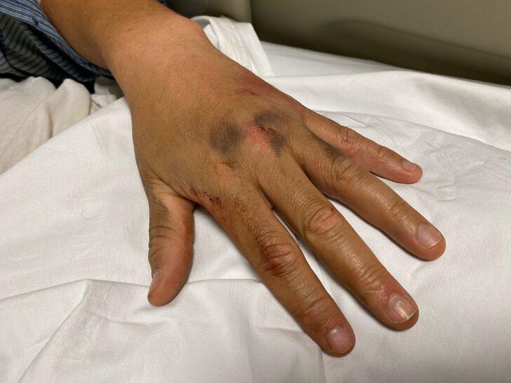 Beyaz kod veren aile hekimi mesai sonrası sopalarla darbedildi G3