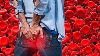 Atardamarı tıkıyor, teşhis edilemiyor! Yüksek kolesterolün yıkıcı etkileri