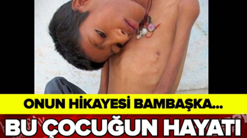 Bu &Ccedil;ocuğun Hayatı Belgesel Oldu