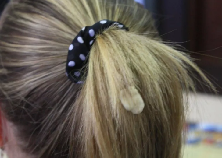 SAÇA VE KIYAFETE YAPIŞAN SAKIZ 