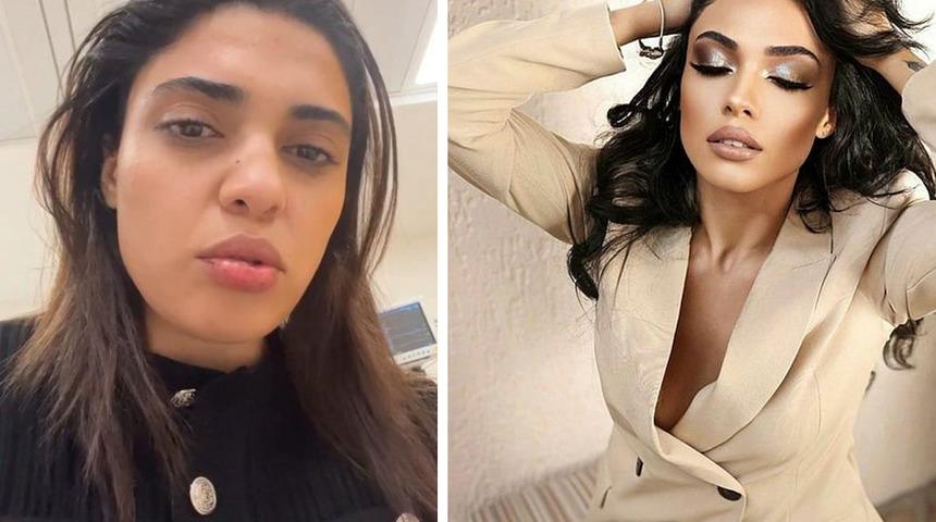 Korna çaldığı taksici, dehşeti yaşattı! Azerbaycanlı şarkıcıya saldırı... "Saçımdan tutarak yüzümü yumrukladı"