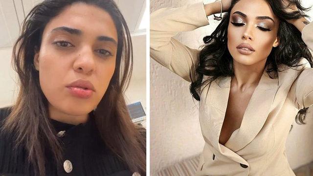 Korna çaldığı taksici, dehşeti yaşattı! Azerbaycanlı şarkıcıya saldırı... Saçımdan tutarak yüzümü yumrukladı