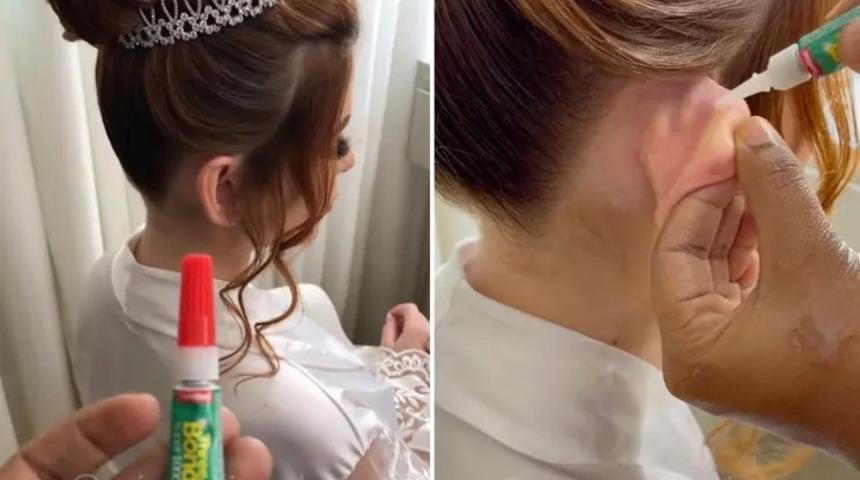 Güzellik uğruna bunu da yaptılar! Düğün gününde mükemmel görünmek istedi