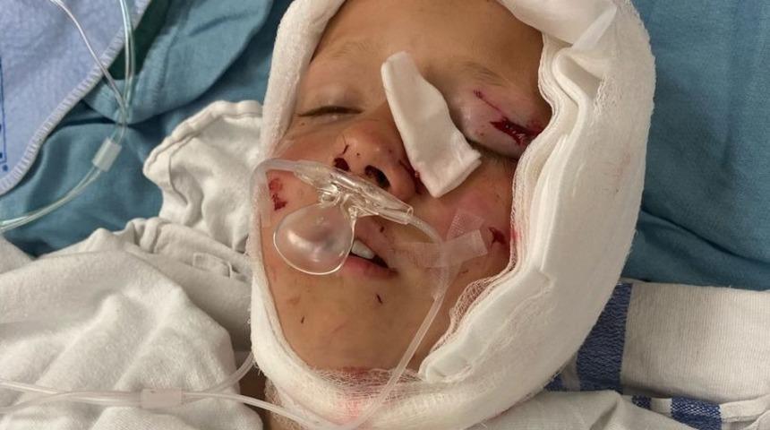 Vücudunu bir araya getirmek için 200 zımba kullandılar! Ona 'mucize çocuk' diyorlar