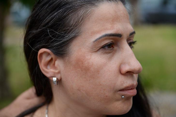 Antalya'da "seyyar güzellik aracında" cildine zarar verildiğini iddia eden kadın şikayetçi oldu G2