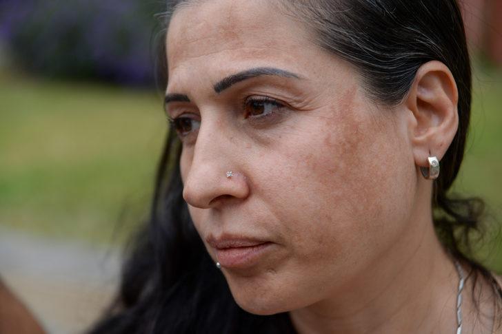 Antalya'da "seyyar güzellik aracında" cildine zarar verildiğini iddia eden kadın şikayetçi oldu G3