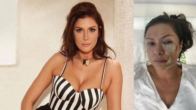 2. Sayfa konuğu Tuğba Altıntop kimdir, kaç yaşında? Köpek saldırısına uğrayan Tuğba Altıntop'un son hali!