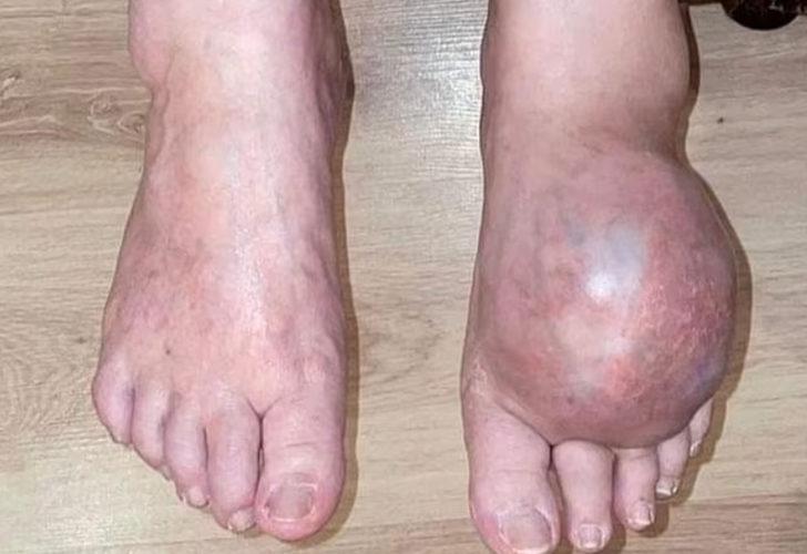 Doktorun korkunç hatası onu bu hale getirdi! Şimdi ölümle karşı karşıya