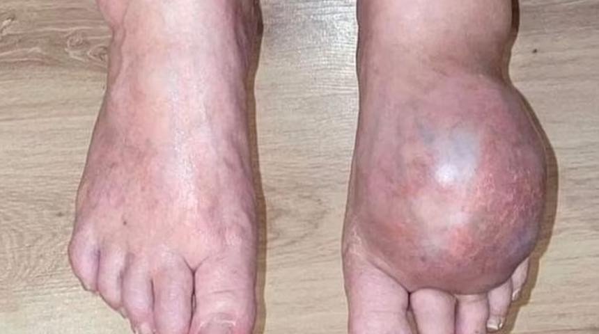 Doktorun korkun&ccedil; hatası onu bu hale getirdi! Şimdi &ouml;l&uuml;mle karşı karşıya